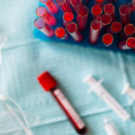 Krew utajoną w kale: Jak prawidłowo pobrać próbkę do badania?